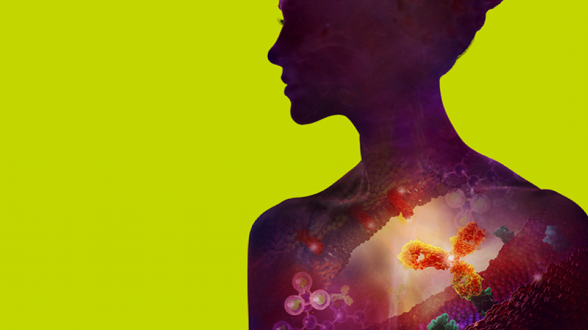 Xcq5dam web 1200 Green Sil png pagespeed ic tf T9 G4 Kmk