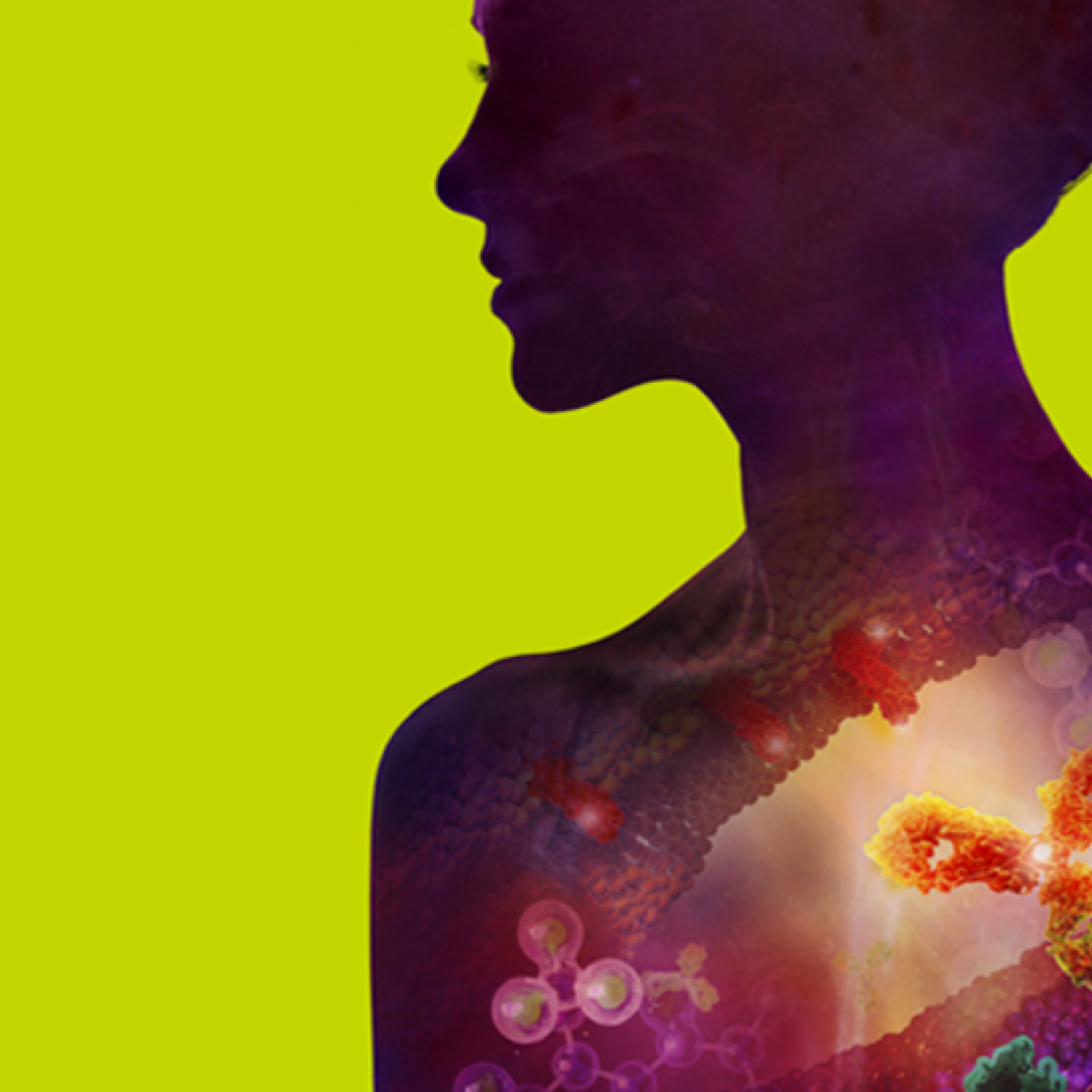 Xcq5dam web 1200 Green Sil png pagespeed ic tf T9 G4 Kmk